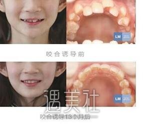 好佰年口腔,牙齿矫正