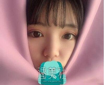 沈阳医大,黄威,双眼皮