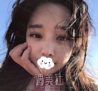 刘辅蓉,双眼皮