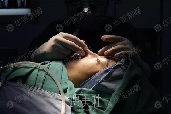 欧阳春鼻子案例：隆鼻找对医生很重要啊!
