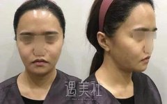 穆宝安的面部提升技术怎样?有真实案例吗? width=