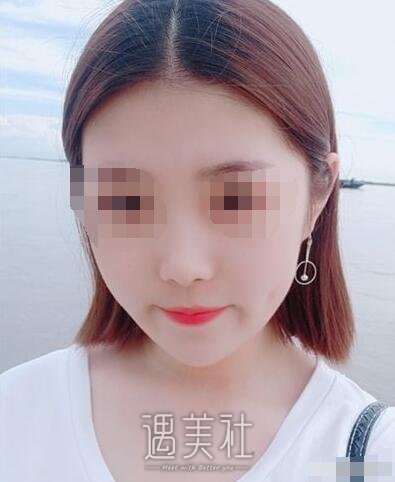 郴州维纳斯整形怎么样?有相关的隆鼻案例吗?
