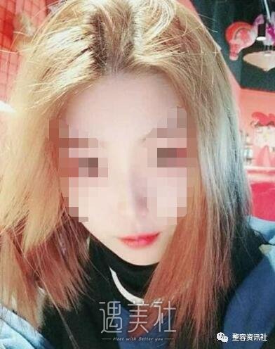郴州维纳斯整形怎么样?有相关的隆鼻案例吗?