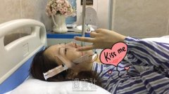 假体隆鼻十五天果图|假体隆鼻术后真实记录~ width=