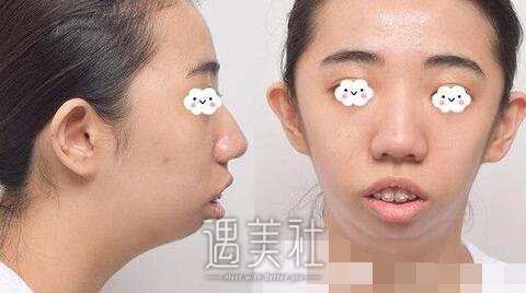云南省口腔医院,黎明
