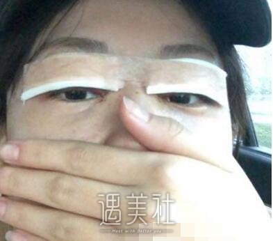 韩新鸣,双眼皮