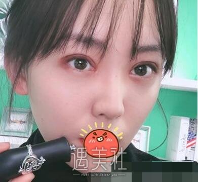 韩新鸣,双眼皮