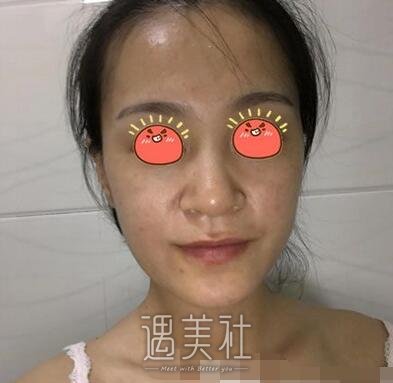武汉,亚太,程晓林