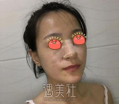 武汉,亚太,程晓林