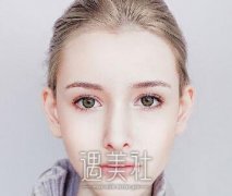 重庆华美李富强做双眼皮要多少钱？贵不贵？ width=