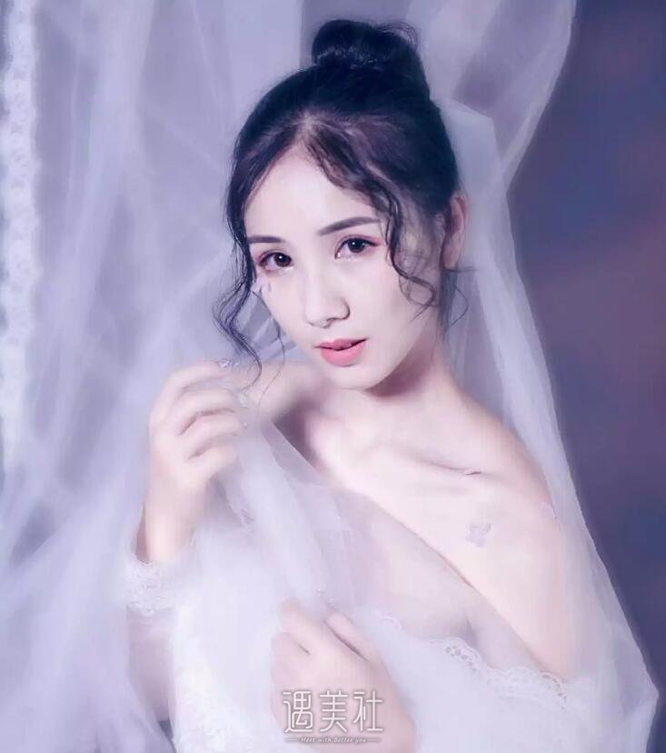 秦皇岛巧致医院怎么样?双眼皮案例及果图分享~