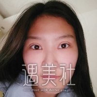 西京医院整形科眼部手术案例一览|果真的那么好?