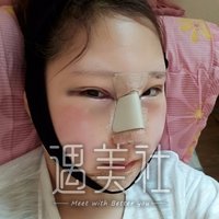 杭州维多利亚许凤芝案例：谢谢医生让我重拾自信!