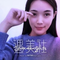 西安孙峰双眼皮案例：这果简直不要太棒!