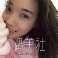 西安孙峰双眼皮案例：这果简直不要太棒!
