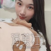 西安孙峰双眼皮案例：这果简直不要太棒!