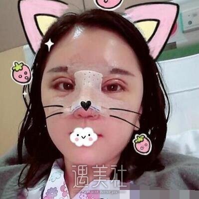 上海,张余光,双眼皮