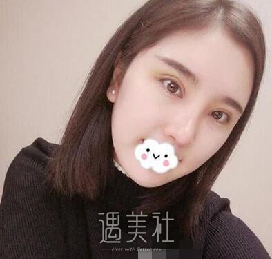 上海,张余光,双眼皮