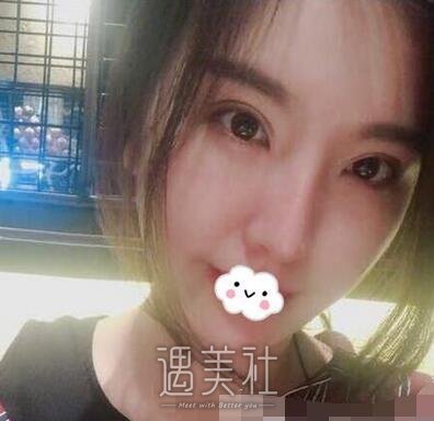 上海,张余光,双眼皮