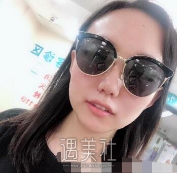 陈文,双眼皮