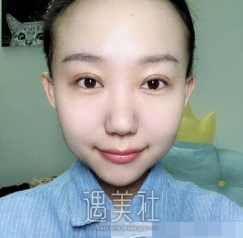 陈文,双眼皮