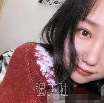 陈文,双眼皮