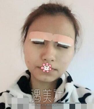 兰大二院,孙一岚,双眼皮