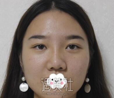 闵英俊