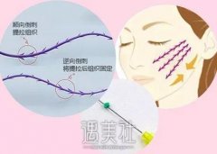 面部提升能做几次，第一次和第3次区别是什么？ width=