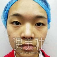 八大处杨明勇案例图片：杨医生技术果然很六!