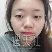 绵阳朗睿整形医院案例分享|看看其实力到底如何? width=