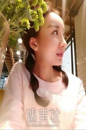 深圳恩吉娜双眼皮案例：是我喜欢的亚子!