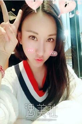 深圳恩吉娜双眼皮案例：是我喜欢的亚子!