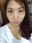 淄博一美整形美容医院祛斑怎么样?有真实案例吗? width=