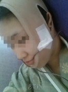 上海改脸型要多少钱?听说那边很多机构可以做~ width=