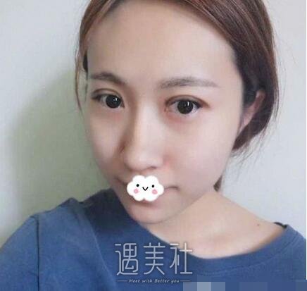 西京,张辉,双眼皮