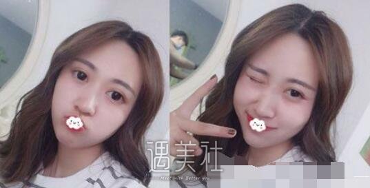 西京,张辉,双眼皮