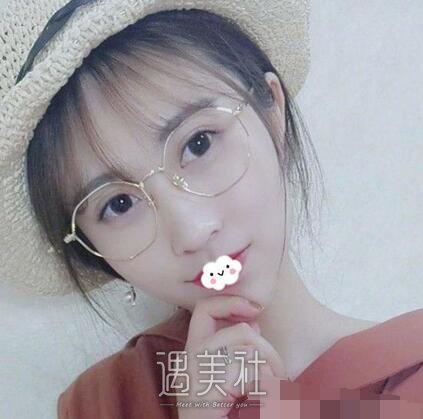 西京,张辉,双眼皮