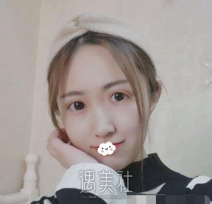 西京,张辉,双眼皮