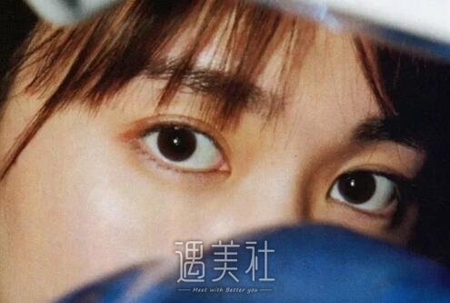 天津,伊美尔,双眼皮
