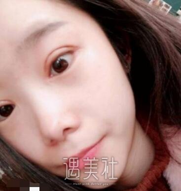 八大处,杨明勇,双眼皮