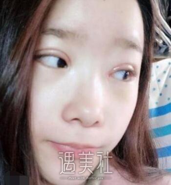 八大处,杨明勇,双眼皮