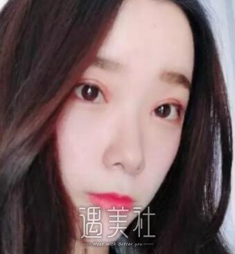 八大处,杨明勇,双眼皮