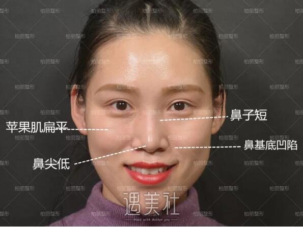 李劲良做鼻子什么风格?想看看案例呢?