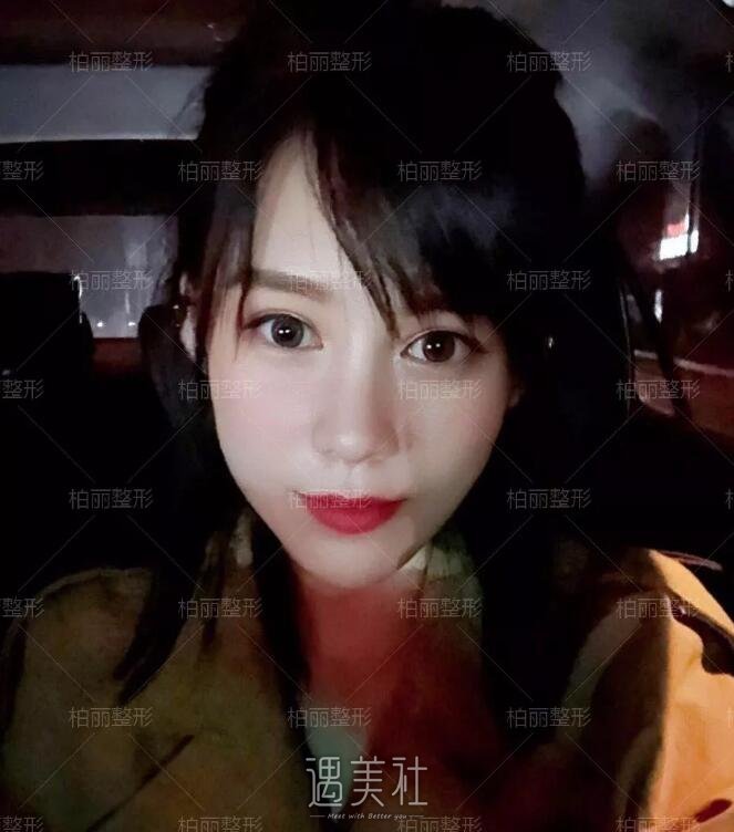 李劲良做鼻子什么风格?想看看案例呢?