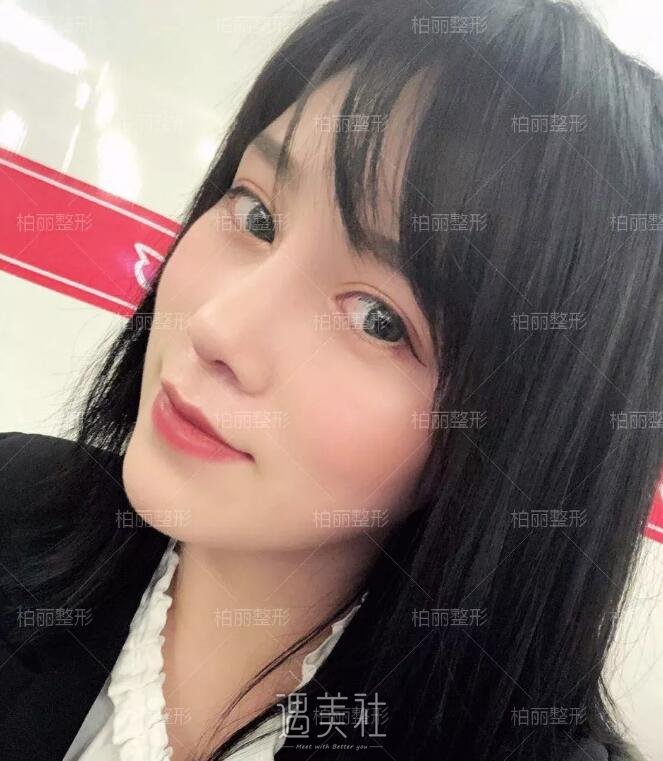 李劲良做鼻子什么风格?想看看案例呢?