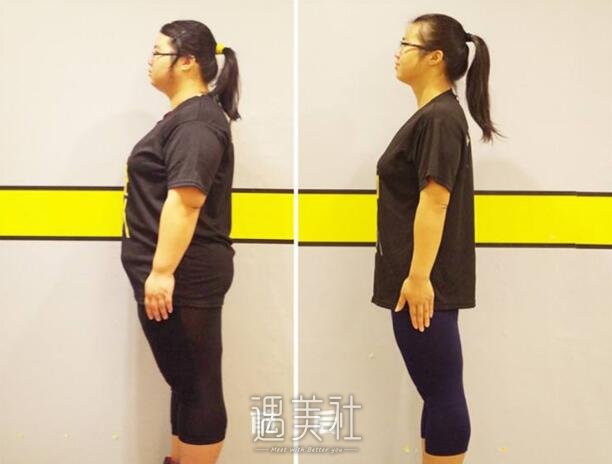 上海九院抽脂手术价格是多少?贵不贵喃?