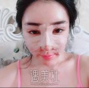伊莱美王世专假体隆鼻真实案例：术前术后对比~ width=