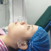 夏相员做鼻子怎么样|夏相员隆鼻案例分享哦~ width=
