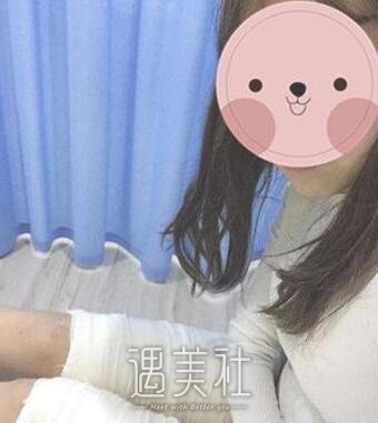 腿部抽脂